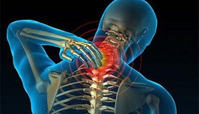 Příznaky osteochondrosy krční páteře